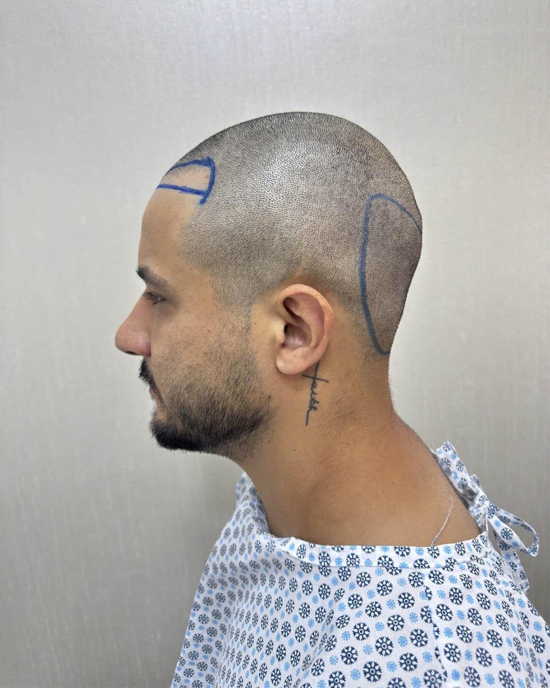 Caso 6 - Antes