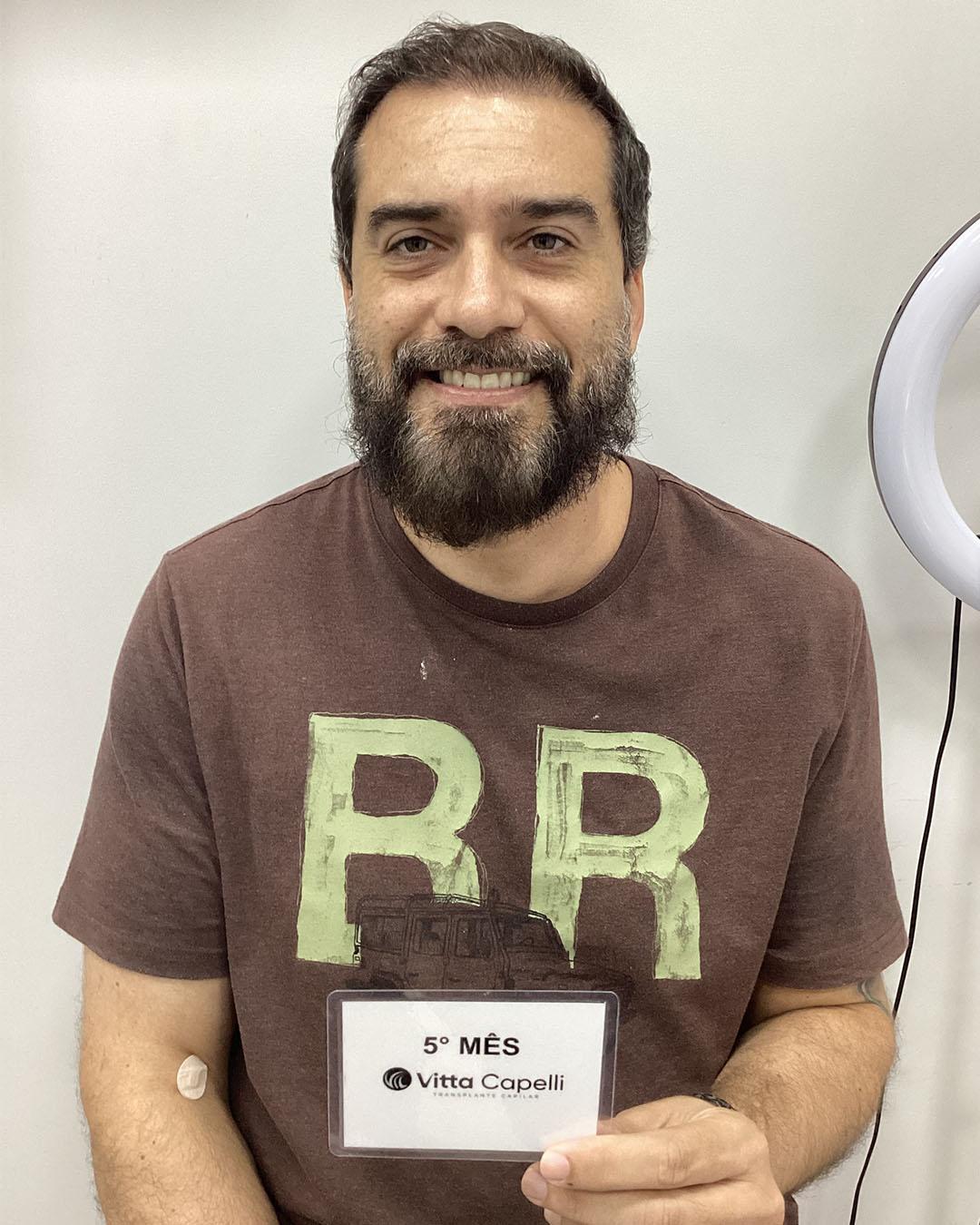 Eric Leonardo - Depois
